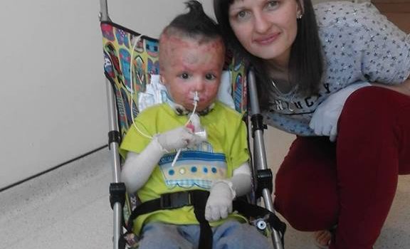 Хлопчик, який горів живцем, повернувся додому або як людська небайдужість врятувала дитину Хлопчик, який горів живцем, повернувся додому або як людська небайдужість врятувала дитину