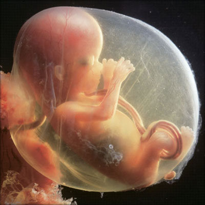 плід на 14 тижні вагітності (фото з мережі Інтернет)